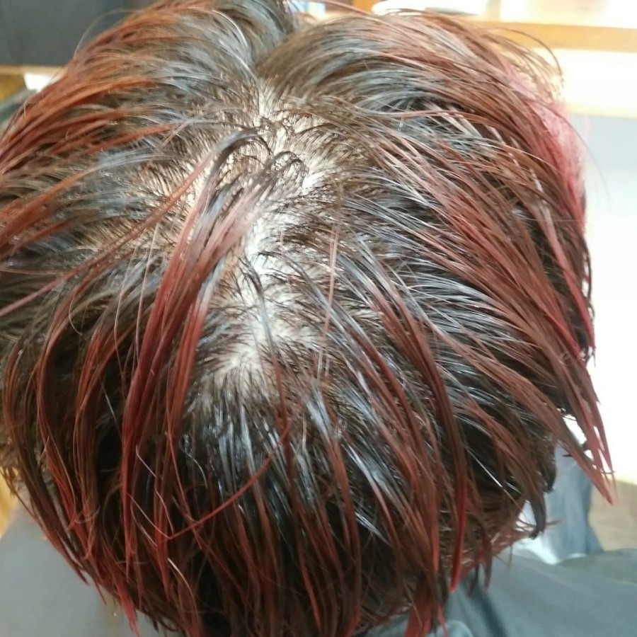 머리카락의 구조와 성분(2번째 이야기 상담 사례 이미지