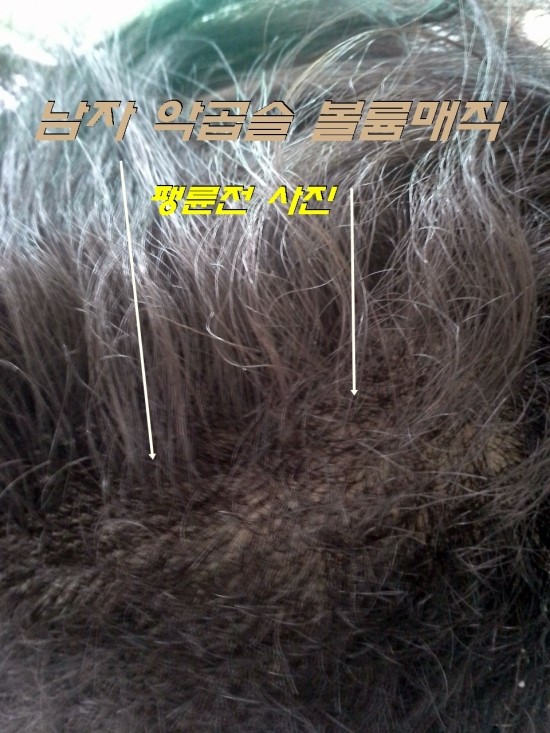알칼리수로 악곱슬 해결 볼륨매직과 투블럭 커트wm헤어 상담 사례 이미지