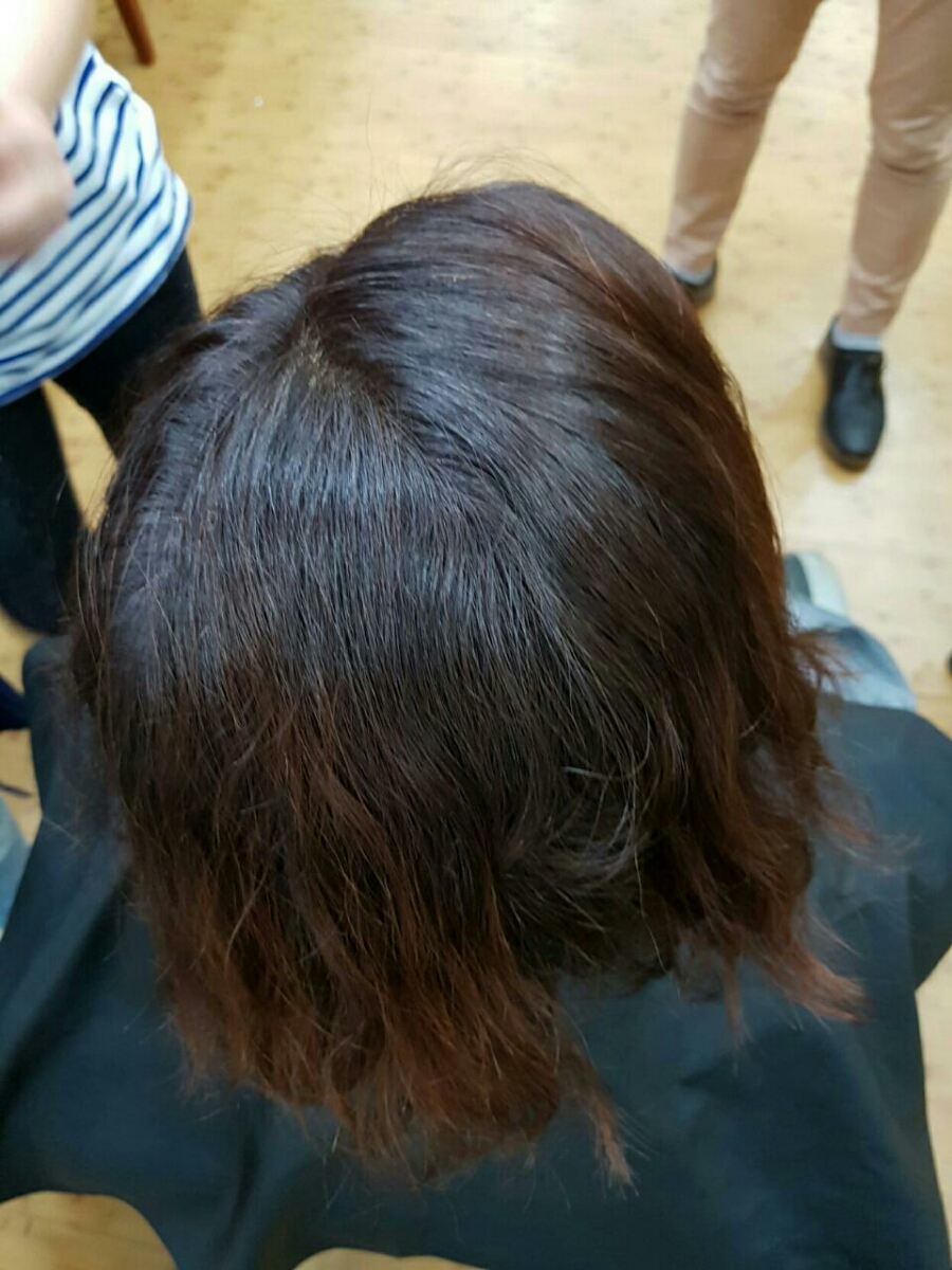 블랙빼기 모완페어 상담 사례 이미지