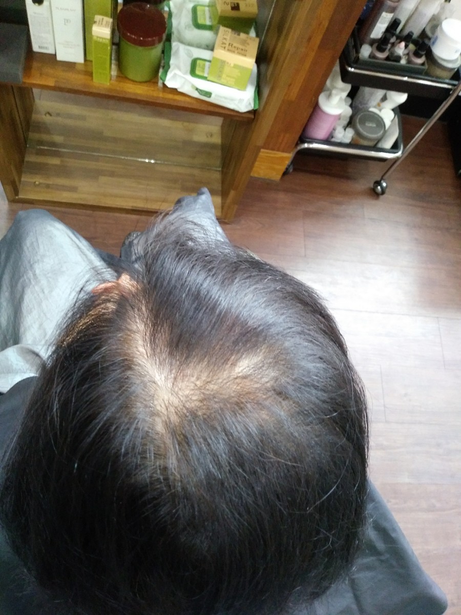 모채수 탈모샴푸 아현동.영주미용실 구매문의 상담 사례 이미지